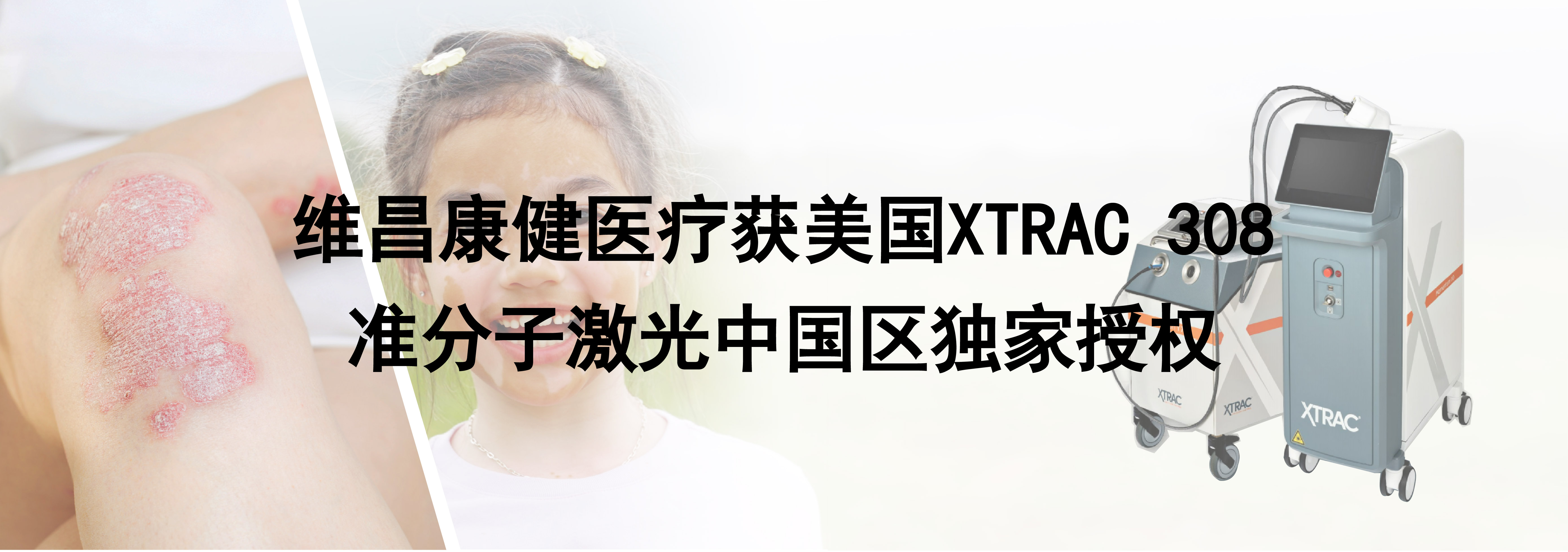 浅层X线放射治疗系统  SRT-100仪器  ./uploadpic/image/202605/20260521084840_74305.jpg